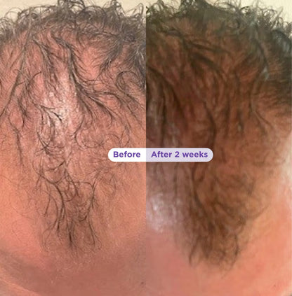 Dr. Groot Biotin & Rosemary Thickening Shampoo & Conditioner Set