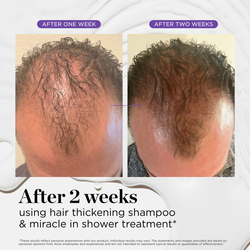 Dr. Groot™ Hair Thickening Trio – Shampoo, Conditioner & Scalp Serum